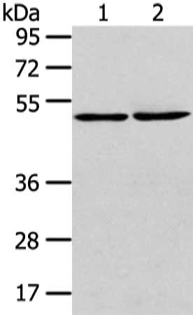 Gel: 8%SDS-PAGE, Lysate: 40 μg, Lane 1-2: A431 cell and human lung cancer tissue, Primary antibody: TBC1D22A Antibody(TBC1D22A Antibody) at dilution 1/300 dilution, Secondary antibody: Goat anti rabbit IgG at 1/8000 dilution, Exposure time: 1 minuteRabbit anti-Human TBC1D22A Polyclonal Antibody