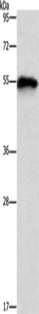 Gel: 6%SDS-PAGE, Lysate: 40μg, Lane: Mouse heart tissue, Primary antibody: CDK19 Antibody(CDK19 Antibody) at dilution 1/1000, Secondary antibody: Goat anti rabbit IgG at 1/8000 dilution, Exposure time: 3 secondsRabbit anti-Human CDK19 Polyclonal Antibody