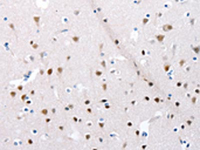 The image on the left is immunohistochemistry of paraffin-embedded Human brain tissue using the antibody Antibody) at dilution 1/30, on the right is treated with synthetic peptide. (Original magnification: ×200)Rabbit anti-Human POMC Polyclonal Antibody