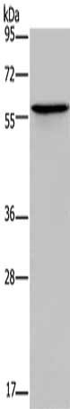 Gel: 10%SDS-PAGE, Lysate: 40 μg, Lane: Human lung cancer tissue, Primary antibody: ADRA1B Antibody(ADRA1B Antibody) at dilution 1/550, Secondary antibody: Goat anti rabbit IgG at 1/8000 dilution, Exposure time: 1 minuteRabbit anti-Human ADRA1B Polyclonal Antibody