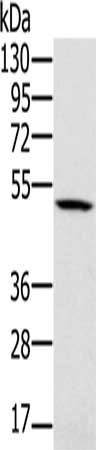 Gel: 8%SDS-PAGE, Lysate: 40 μg, Lane: 231 cells, Primary antibody: PSMC2 Antibody(PSMC2 Antibody) at dilution 1/500, Secondary antibody: Goat anti rabbit IgG at 1/8000 dilution, Exposure time: 5 secondsRabbit anti-Human PSMC2 Polyclonal Antibody