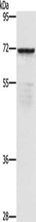 Gel: 8%SDS-PAGE, Lysate: 40 μg, Lane: 231 cells, Primary antibody: ZMYND11 Antibody(ZMYND11 Antibody) at dilution 1/550, Secondary antibody: Goat anti rabbit IgG at 1/8000 dilution, Exposure time: 1 minuteRabbit anti-Human ZMYND11 Polyclonal Antibody