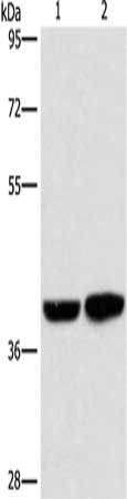Gel: 8%SDS-PAGE, Lysate: 40 μg, Lane 1-2: Human fetal brain tissue, 231 cells, Primary antibody: CAB39L Antibody(CAB39L Antibody) at dilution 1/350, Secondary antibody: Goat anti rabbit IgG at 1/8000 dilution, Exposure time: 15 seconds