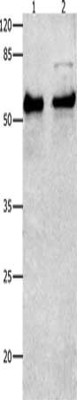 Gel: 10%SDS-PAGE, Lysate: 30 μg, Lane 1-2: Human liver cancer tissue, Hela cells, Primary antibody: SMAD4 Antibody(SMAD4 Antibody) at dilution 1/150, Secondary antibody: Goat anti rabbit IgG at 1/8000 dilution, Exposure time: 2 minutesRabbit anti-Human SMAD4 Polyclonal Antibody