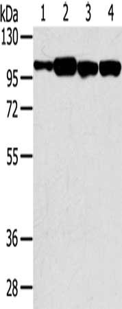 Gel: 6%SDS-PAGE, Lysate: 40 μg, Lane 1-4: Hepg2 cells, TM4 cells, 293T cells, NIH/3T3 cells, Primary antibody: SRGAP1 Antibody(SRGAP1 Antibody) at dilution 1/200, Secondary antibody: Goat anti rabbit IgG at 1/8000 dilution, Exposure time: 20 seconds