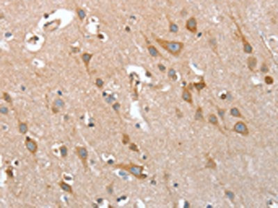 The image on the left is immunohistochemistry of paraffin-embedded Human brain  tissue using TP53BP2 Antibody(TP53BP2 Antibody) at dilution 1/35, on the right is treated with fusion protein. (Original magnification: ×200)Rabbit anti-Human TP53BP2 Polyclonal Antibody