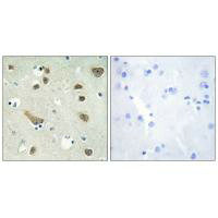 Immunohistochemistry analysis of paraffin-embedded human brain tissue using 14-3-3 γ antibody.Rabbit anti-Human YWHAG Polyclonal Antibody