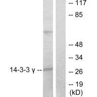 Western blot analysis of extracts from K562 cells, treated with insulin (0.01U/ml, 15mins), using 14-3-3 γ antibody.Rabbit anti-Human YWHAG Polyclonal Antibody