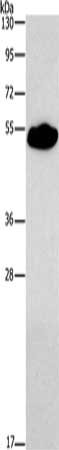 Gel: 8%SDS-PAGE, Lysate: 40 μg, Lane: Mouse heart tissue, Primary antibody: SMAD9 Antibody(SMAD9 Antibody) at dilution 1/290, Secondary antibody: Goat anti rabbit IgG at 1/8000 dilution, Exposure time: 3 minutesRabbit anti-Human SMAD9 Polyclonal Antibody