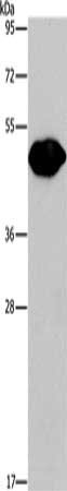 Gel: 8%SDS-PAGE, Lysate: 40 μg, Lane: Mouse brain tissue, Primary antibody: PLIN2 Antibody(PLIN2 Antibody) at dilution 1/680, Secondary antibody: Goat anti rabbit IgG at 1/8000 dilution, Exposure time: 1 minuteRabbit anti-Human PLIN2 Polyclonal Antibody