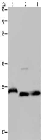 Gel: 8%SDS-PAGE, Lysate: 40 μg, Lane 1-3: Human placenta tissue, HT29 cells, human fetal brain tissue, Primary antibody: GSTP1 Antibody(GSTP1 Antibody) at dilution 1/300, Secondary antibody: Goat anti rabbit IgG at 1/8000 dilution, Exposure time: 10 secondsRabbit anti-Human GSTP1 Polyclonal Antibody