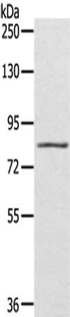 Gel: 6%SDS-PAGE,Lysate: 40 μg,,Primary antibody: SRPK1 Antibody(SRPK1 Antibody) at dilution 1/600 dilution,Secondary antibody: Goat anti rabbit IgG at 1/8000 dilution,Exposure time: 2 minutesRabbit anti-Human SRPK1 Polyclonal Antibody