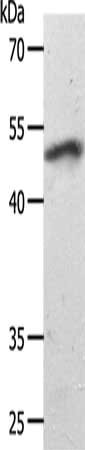 Gel: 10%SDS-PAGE, Lysate: 40 μg, Lane: Mouse heart tissue, Primary antibody: SMAD7 Antibody(SMAD7 Antibody) at dilution 1/1000, Secondary antibody: Goat anti rabbit IgG at 1/8000 dilution, Exposure time: 40 secondsRabbit anti-Human SMAD7 Polyclonal Antibody