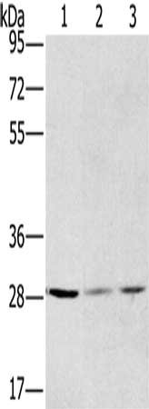 Gel: 8%SDS-PAGE, Lysate: 40 μg, Lane 1-3: A375 cells, hela cells, A172 cells, Primary antibody: HSD17B12 Antibody(HSD17B12 Antibody) at dilution 1/570, Secondary antibody: Goat anti rabbit IgG at 1/8000 dilution, Exposure time: 30 secondsRabbit anti-Human HSD17B12 Polyclonal Antibody