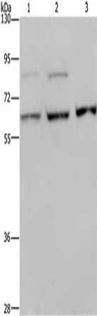 Gel: 8%SDS-PAGE, Lysate: 40 μg, Lane 1-3: A431 cells, MCF7 cells, Hela cells, Primary antibody: KIF22 Antibody(KIF22 Antibody) at dilution 1/200, Secondary antibody: Goat anti rabbit IgG at 1/8000 dilution, Exposure time: 10 minutesRabbit anti-Human KIF22 Polyclonal Antibody