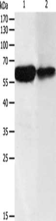 Gel: 12%SDS-PAGE, Lysate: 50 μg, Lane 1-2: Human liver cancer tissue, Human fetal liver tissue, Primary antibody: DCT Antibody(DCT Antibody) at dilution 1/200, Secondary antibody: Goat anti rabbit IgG at 1/8000 dilution, Exposure time: 5 minutesRabbit anti-Human DCT Polyclonal Antibody