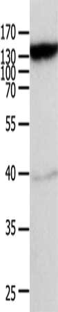 Gel: 10%SDS-PAGE, Lysate: 40μg, Lane: Mouse heart tissue, Primary antibody: ABCC5 Antibody(ABCC5 Antibody) at dilution 1/950, Secondary antibody: Goat anti rabbit IgG at 1/8000 dilution, Exposure time: 10 minutes