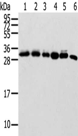 Gel: 12%SDS-PAGE,Lysate: 40 μg,Lane 1-6: 293T cells, Hela cells, Lovo cells, Raji cells, HUEVC cells, Mouse spleen tissue,Primary antibody: SENP8 Antibody(SENP8 Antibody) at dilution 1/600 dilution,Secondary antibody: Goat anti rabbit IgG at 1/8000 dilution,Exposure time: 20 seconds
