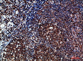 Immunohistochemical analysis of paraffin-embedded human-tonsil, antibody was diluted at 1:200Rabbit anti-Human CYFIP2 Polyclonal Antibody