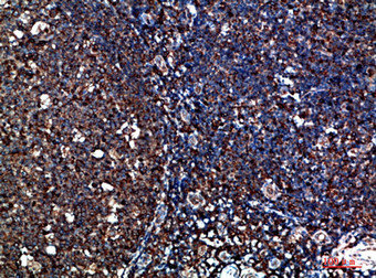 Immunohistochemical analysis of paraffin-embedded human-tonsil, antibody was diluted at 1:200Rabbit anti-Human CYFIP2 Polyclonal Antibody