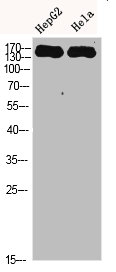 Western Blot analysis of HEPG2 Hela cells using CYFIP2 Polyclonal Antibody diluted at 1:500. Secondary antibody  was diluted at 1:20000Rabbit anti-Human CYFIP2 Polyclonal Antibody