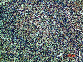 Immunohistochemical analysis of paraffin-embedded human-tonsils, antibody was diluted at 1:200