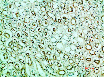 Immunohistochemical analysis of paraffin-embedded human-kidney, antibody was diluted at 1:200