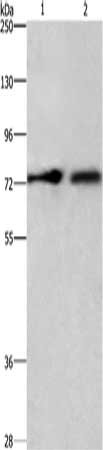 Gel: 6%SDS-PAGE, Lysate: 80 μg, Lane 1-2: A549 cells, hepG2 cells, Primary antibody: CDCP1 Antibody(CDCP1 Antibody) at dilution 1/800, Secondary antibody: Goat anti rabbit IgG at 1/8000 dilution, Exposure time: 10 secondsRabbit anti-Human CDCP1 Polyclonal Antibody