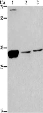 Gel: 8%SDS-PAGE,Lysate: 40 μg,Lane 1-3: Jurkat cells, Hela cells, HT-29 cells,Primary antibody: CDK1 Antibody(CDK1 Antibody) at dilution 1/300 dilution,Secondary antibody: Goat anti rabbit IgG at 1/8000 dilution,Exposure time: 5 minutesRabbit anti-Human CDK1 Polyclonal Antibody