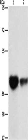 Gel: 10%SDS-PAGE, Lysate: 40 μg, Lane 1-2: Mouse brain tissue, NIH/3T3 cells, Primary antibody: IDH3G Antibody(IDH3G Antibody) at dilution 1/350, Secondary antibody: Goat anti rabbit IgG at 1/8000 dilution, Exposure time: 15 secondsRabbit anti-Human IDH3G Polyclonal Antibody