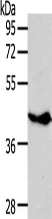 Gel: 10%SDS-PAGE, Lysate: 40 μg, Lane: Raji cells, Primary antibody: NFKBIE Antibody(NFKBIE Antibody) at dilution 1/350, Secondary antibody: Goat anti rabbit IgG at 1/8000 dilution, Exposure time: 1 minuteRabbit anti-Human NFKBIE Polyclonal Antibody