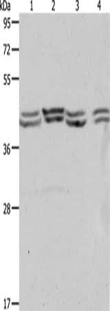 Gel: 10%SDS-PAGE, Lysate: 40 μg, Lane 1-4: Hela cells, 293T cells, NIH/3T3 cells, Jurkat cells, Primary antibody: PSMD6 Antibody(PSMD6 Antibody) at dilution 1/650, Secondary antibody: Goat anti rabbit IgG at 1/8000 dilution, Exposure time: 1 minuteRabbit anti-Human PSMD6 Polyclonal Antibody