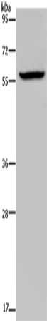 Gel: 8%SDS-PAGE, Lysate: 40 μg, Lane: Human fetal brain tissue, Primary antibody: KDM4D Antibody(KDM4D Antibody) at dilution 1/1100, Secondary antibody: Goat anti rabbit IgG at 1/8000 dilution, Exposure time: 10 minutes