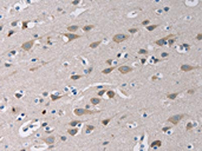 The image on the left is immunohistochemistry of paraffin-embedded Human brain tissue using the antibody Antibody) at dilution 1/20, on the right is treated with fusion protein. (Original magnification: ×200)Rabbit anti-Human TLR1 Polyclonal Antibody