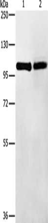 Gel: 8%SDS-PAGE, Lysate: 40 μg, Lane 1-2: Mouse thymus tissue, K562 cells, Primary antibody: TLR1 Antibody(TLR1 Antibody) at dilution 1/175, Secondary antibody: Goat anti rabbit IgG at 1/8000 dilution, Exposure time: 10 secondsRabbit anti-Human TLR1 Polyclonal Antibody