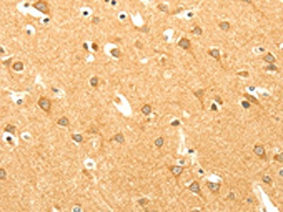 The image on the left is immunohistochemistry of paraffin-embedded Human brain  tissue using AARS2 Antibody(AARS2 Antibody) at dilution 1/40, on the right is treated with fusion protein. (Original magnification: ×200)