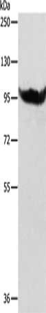 Gel: 8%SDS-PAGE, Lysate: 40 μg, Lane: SP20 cells, Primary antibody: AARS2 Antibody(AARS2 Antibody) at dilution 1/600, Secondary antibody: Goat anti rabbit IgG at 1/8000 dilution, Exposure time: 15 seconds
