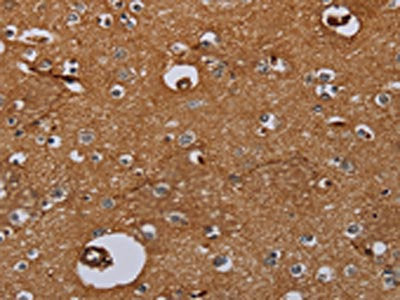 The image on the left is immunohistochemistry of paraffin-embedded Human brain  tissue using IL27RA Antibody(IL27RA Antibody) at dilution 1/40, on the right is treated with fusion protein. (Original magnification: ×200)Rabbit anti-Human IL27RA Polyclonal Antibody