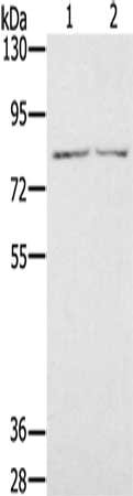 Gel: 6%SDS-PAGE, Lysate: 40 μg, Lane 1-2: Mouse thymus tissue, Mouse heart tissue, Primary antibody: IL27RA Antibody(IL27RA Antibody) at dilution 1/400, Secondary antibody: Goat anti rabbit IgG at 1/8000 dilution, Exposure time: 30 secondsRabbit anti-Human IL27RA Polyclonal Antibody