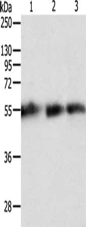 Gel: 10%SDS-PAGE, Lysate: 40 μg, Lane 1-3: Human brain malignant glioma tissue, human seminoma tissue, human liver cancer tissue, Primary antibody: TEKT5 Antibody(TEKT5 Antibody) at dilution 1/600, Secondary antibody: Goat anti rabbit IgG at 1/8000 dilution, Exposure time: 10 minutesRabbit anti-Human TEKT5 Polyclonal Antibody