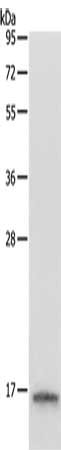 Gel: 12%SDS-PAGE, Lysate: 40 μg, Lane: Hela cells, Primary antibody: LYZ Antibody(LYZ Antibody) at dilution 1/200, Secondary antibody: Goat anti rabbit IgG at 1/8000 dilution, Exposure time: 45 seconds