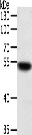 Gel: 10%SDS-PAGE, Lysate: 50 μg, Lane: Jurkat cells, Primary antibody: SUFU Antibody(SUFU Antibody) at dilution 1/100, Secondary antibody: Goat anti rabbit IgG at 1/8000 dilution, Exposure time: 10 secondsRabbit anti-Human SUFU Polyclonal Antibody