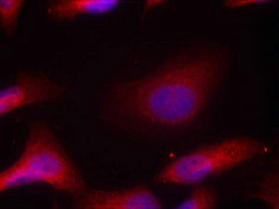 Immunofluorescence staining of methanol-fixed Hela cells using Src(Phospho-Tyr529) Antibody.Rabbit anti-Human SRC Polyclonal Antibody