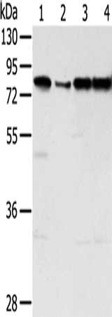 Gel: 8%SDS-PAGE, Lysate: 40 μg, Lane 1-4: Jurkat cells, hepg2 cells, Raji cells, A431 cells, Primary antibody: TAF15 Antibody(TAF15 Antibody) at dilution 1/450, Secondary antibody: Goat anti rabbit IgG at 1/8000 dilution, Exposure time: 10 secondsRabbit anti-Human TAF15 Polyclonal Antibody