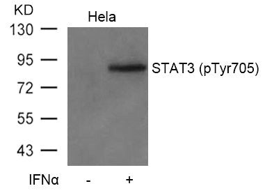 Western blot analysis of extracts from Hela cells untreated or treated with IFN a using STAT3(Phospho-Tyr705) Antibody.Rabbit anti-Human STAT3 Polyclonal Antibody