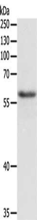 Gel: 10%SDS-PAGE, Lysate: 40 μg, Lane: A549 cells, Primary antibody: TRAF6 Antibody(TRAF6 Antibody) at dilution 1/300, Secondary antibody: Goat anti rabbit IgG at 1/8000 dilution, Exposure time: 10 minutesRabbit anti-Human TRAF6 Polyclonal Antibody