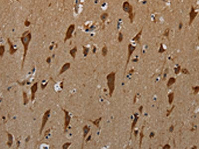 The image on the left is immunohistochemistry of paraffin-embedded Human brain tissue using the antibody Antibody) at dilution 1/50, on the right is treated with synthetic peptide. (Original magnification: ×200)Rabbit anti-Human PKMYT1 Polyclonal Antibody