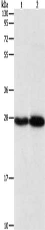 Gel: 10%SDS-PAGE, Lysate: 40 μg, Lane 1-2: Human testis tissue, mouse brain tissue, Primary antibody: PSMB7 Antibody(PSMB7 Antibody) at dilution 1/310, Secondary antibody: Goat anti rabbit IgG at 1/8000 dilution, Exposure time: 5 secondsRabbit anti-Human PSMB7 Polyclonal Antibody
