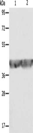 Gel: 10%SDS-PAGE, Lysate: 40 μg, Lane 1-2: A549 cells, hela cells, Primary antibody: ALDOA Antibody(ALDOA Antibody) at dilution 1/500, Secondary antibody: Goat anti rabbit IgG at 1/8000 dilution, Exposure time: 3 secondsRabbit anti-Human ALDOA Polyclonal Antibody