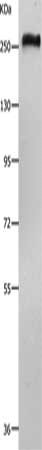 Gel: 8%SDS-PAGE, Lysate: 40μg, Lane: 231 cells, Primary antibody: ACIN1 Antibody(ACIN1 Antibody) at dilution 1/550, Secondary antibody: Goat anti rabbit IgG at 1/8000 dilution, Exposure time: 1 minute